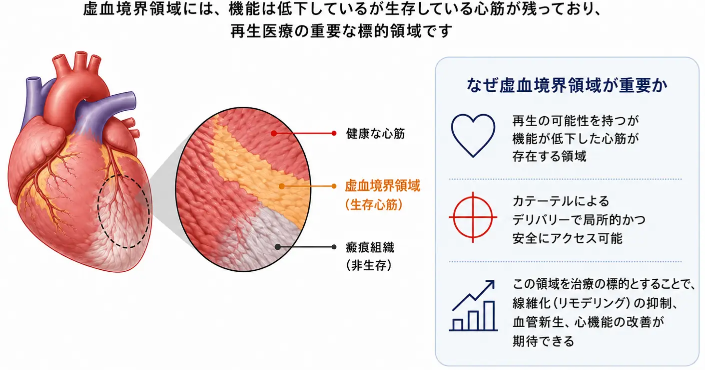 虚血境界領域